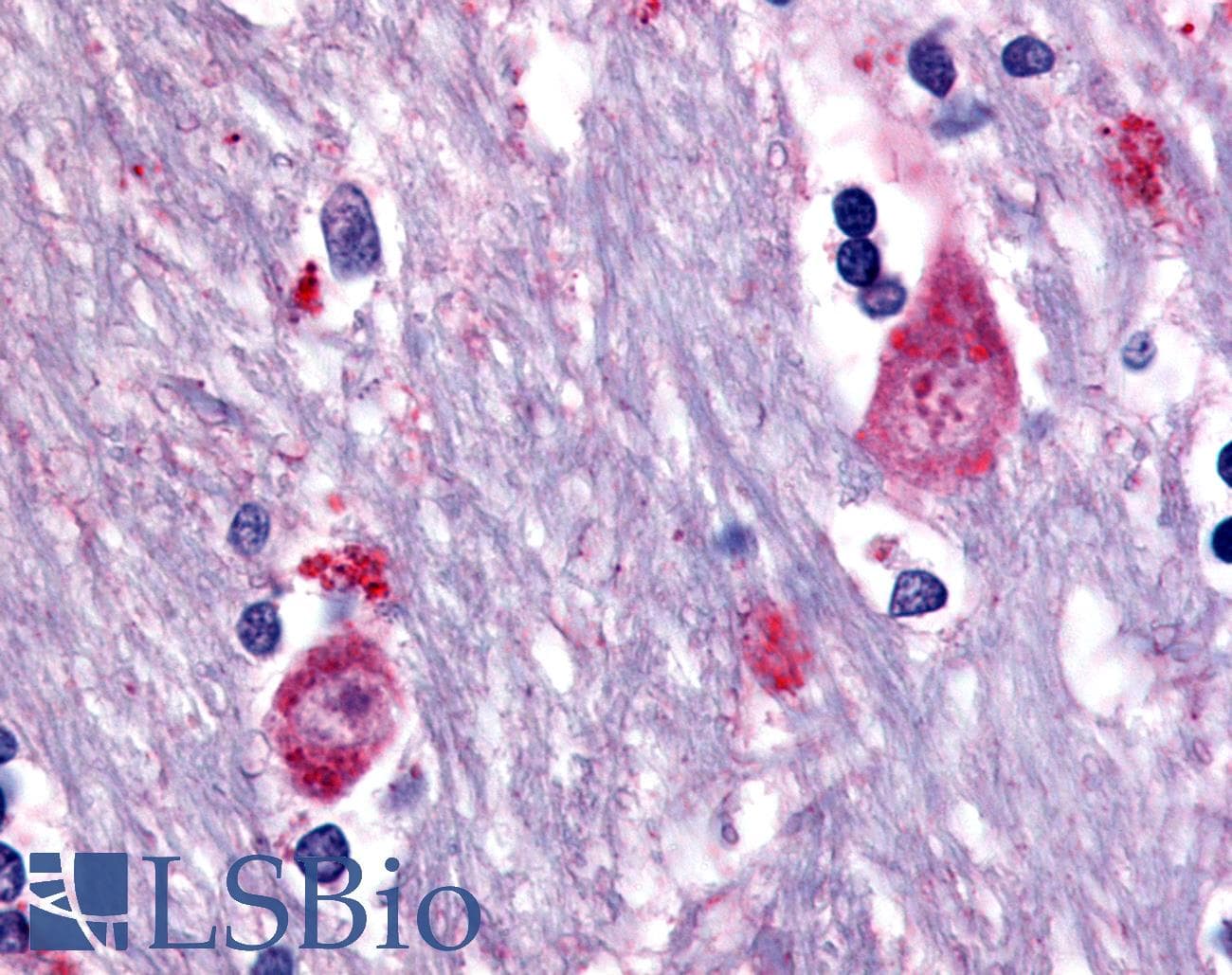 IHC-plus™ CHRM3 / M3 Antibody (Cytoplasmic Domain)