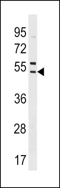 Polyclonal Rabbit anti-Human SNX5 Antibody (aa43-70, WB)