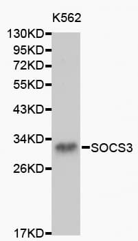 SOCS3 Antibody