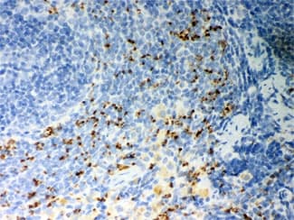 CD36 Antibody