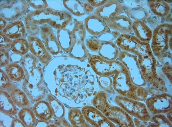 Polyclonal Rabbit anti-Human ITPR1 / IP3 Receptor Type 1 Antibody (aa700-750, IHC)