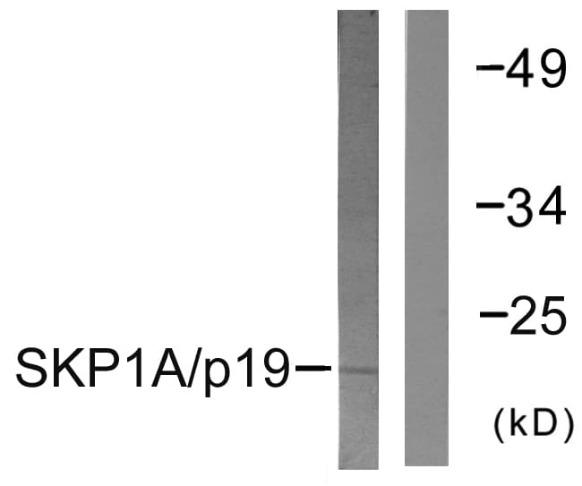 IHC-plus™ Polyclonal Rabbit anti-Human SKP1 Antibody (aa41-90, IHC, WB)