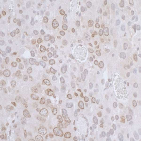 TMPO / TP / Thymopoietin Antibody (aa225-275)