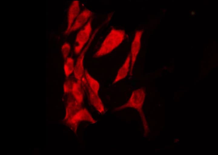 NR3C1/Glucocorticoid Receptor Antibody (phospho-Ser203)