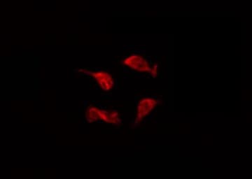 Polyclonal Rabbit anti-Human DCC Antibody (IF, WB)