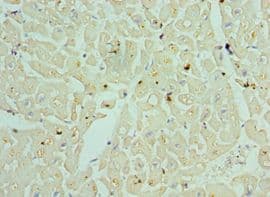 TDG / Thymine DNA Glycosylase Antibody (aa141-410)