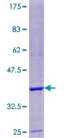 Human ARPC4 Protein (Recombinant GST)
