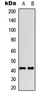 SSTR4 Antibody (Internal)