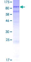 Human ODF2L Protein (Recombinant GST)