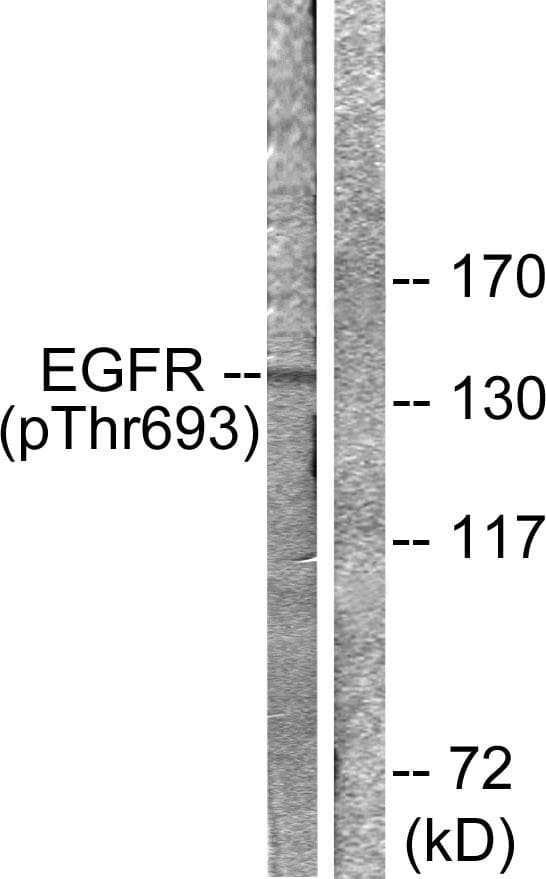 EGFR Antibody (phospho-Thr693)
