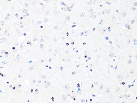 TH / Tyrosine Hydroxylase Antibody