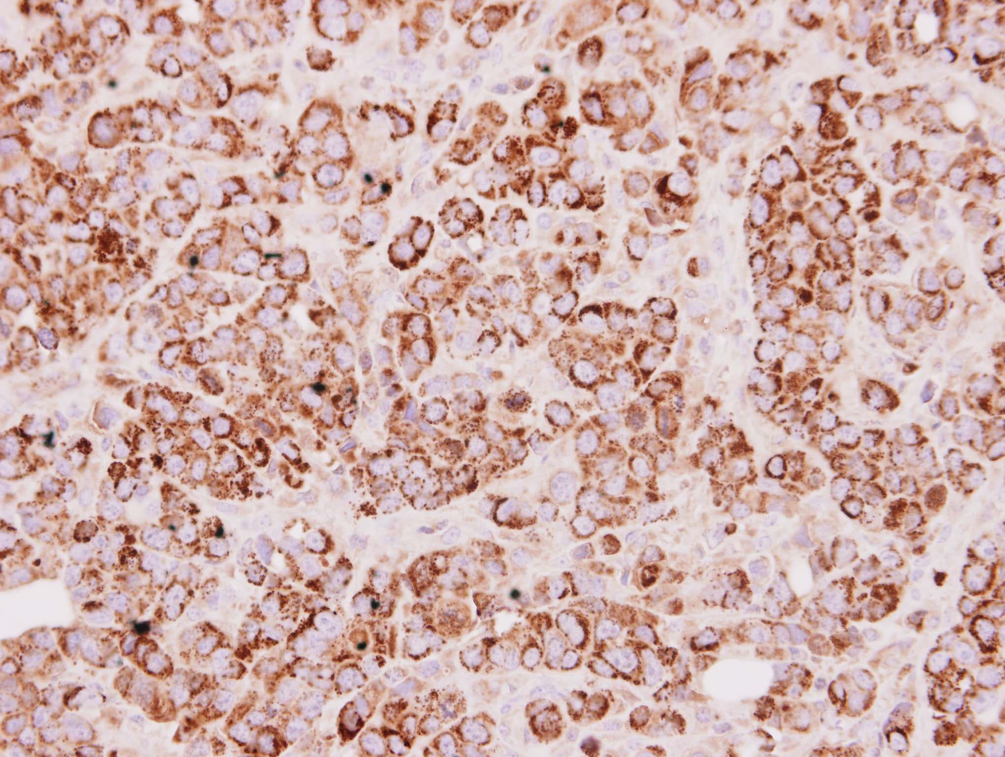 Polyclonal Rabbit anti-Human Rhodanese / TST Antibody (aa1-270, IHC, WB)