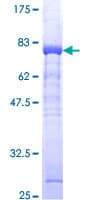Human ADK / Adenosine Kinase Protein (Recombinant GST)