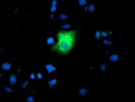 IHC-plus™ Monoclonal Mouse anti-Human MAC-2-BP / LGALS3BP Antibody (clone 3D6, IHC, IF, WB)