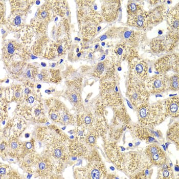 Polyclonal Rabbit anti-Human KIF3A Antibody (IHC, IF, WB)