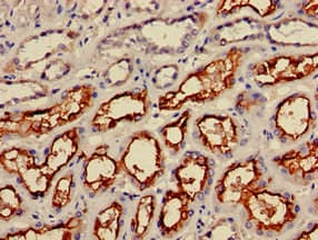 Polyclonal Rabbit anti-Human IRS2 / IRS-2 Antibody (IHC, IF)