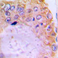 Polyclonal Rabbit anti-Human ADRBK1 / GRK2 Antibody (N-Terminus, IHC, WB)