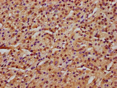 UBR3 Antibody