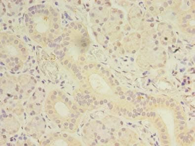 OSR2 Antibody
