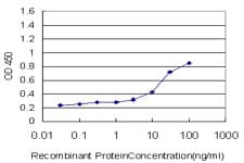 Monoclonal Mouse anti-Human SOCS3 Antibody (clone 1E4)