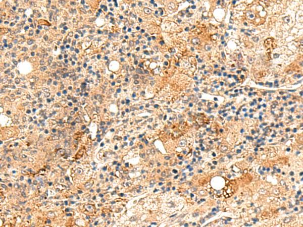REG1B Antibody