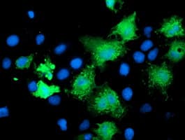 KATNB1 Antibody (clone OTI4C10)