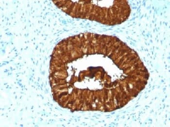 MAML3 / CAGH3 Antibody (clone MAML3/1303)