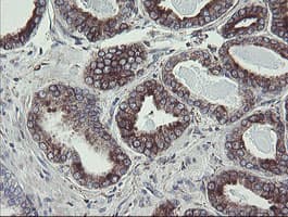 TPD52L3 Antibody (clone OTI8C12)