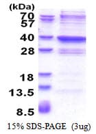 Human GLYATL2 Protein (Recombinant His)