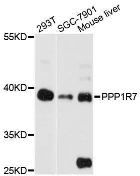 Polyclonal Rabbit anti-Human PPP1R7 Antibody (WB)