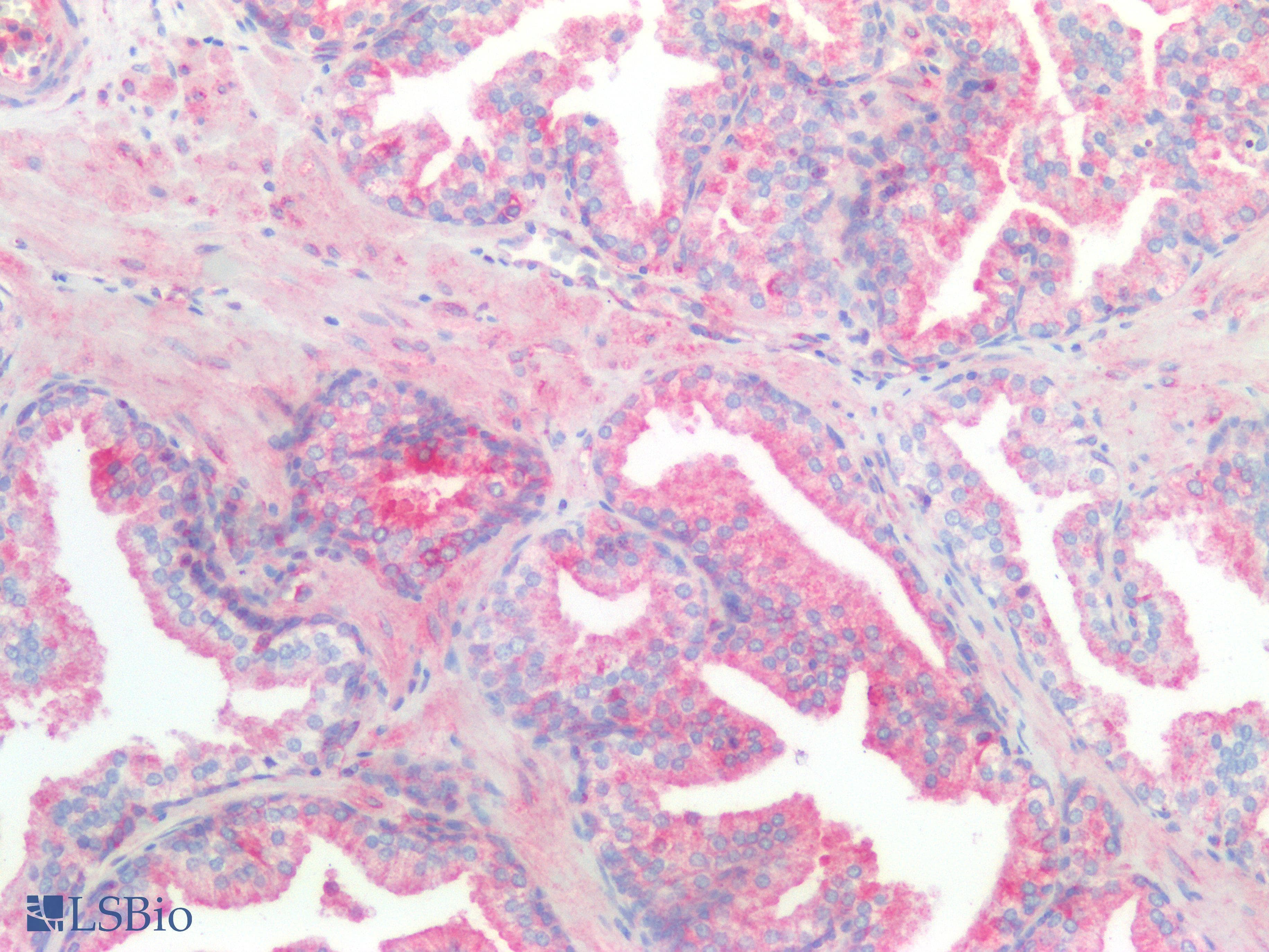 PathPlus™ Kinesin Heavy Chain / KIF5B Antibody