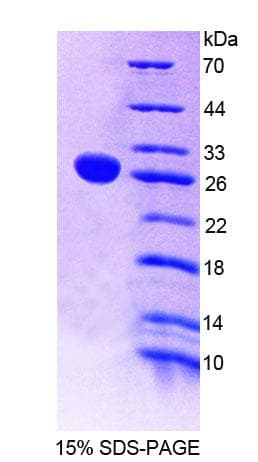 Human NT5C2 Protein (Recombinant His-T7, N-terminus)