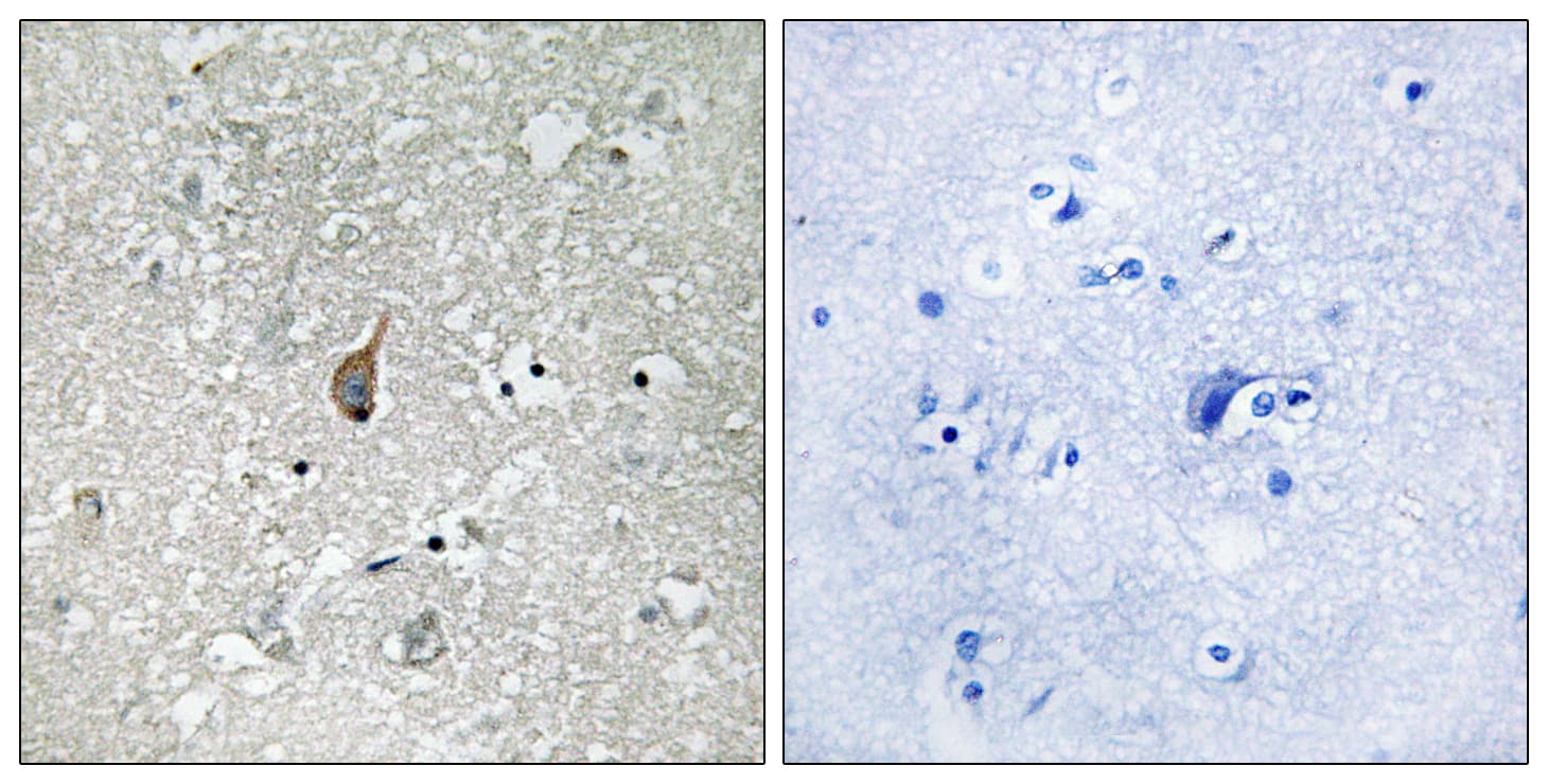 ANAPC1 / APC1 Antibody (phospho-Ser355)