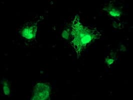 FXN / Frataxin Antibody (clone OTI1C12)
