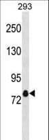 KCNA4 / Kv1.4 Antibody (aa591-619)