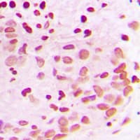 Polyclonal Rabbit anti-Human PML Antibody (N-Terminus, IHC, IF, WB)