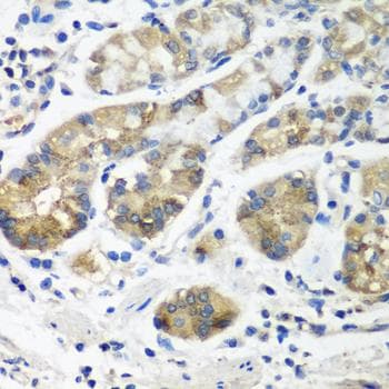 STX16 / Syntaxin 16 Antibody