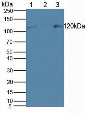 SMARCA3 / HLTF Antibody (aa837-996, APC)
