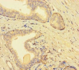TMEM52B / C12orf59 Antibody