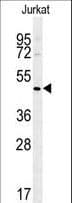 ST3GAL5 / GM3 Synthase Antibody (aa389-418)