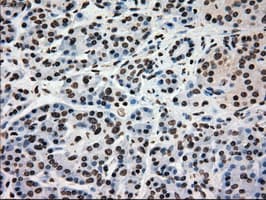 Monoclonal Mouse anti-Human GCK / Glucokinase Antibody (clone OTI3E3, IHC, IF, WB)