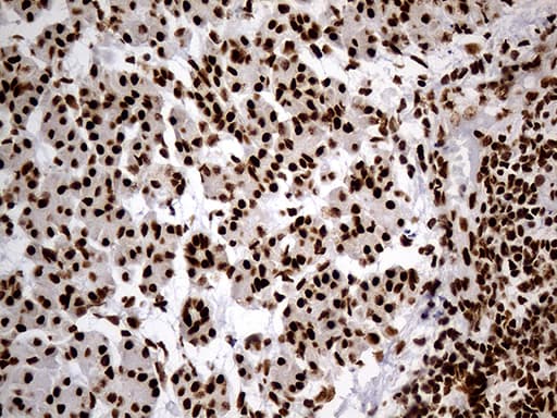Monoclonal Mouse anti-Human HNRNPH1 / hnRNP H Antibody (clone OTI2E8, Carrier-free, IHC, WB)