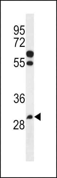 PGAP3 / PERLD1 Antibody (aa141-169)