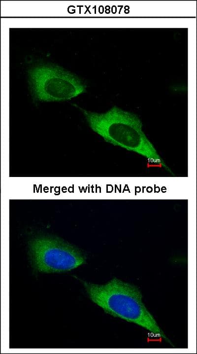 Polyclonal Rabbit anti-Human MTMR9 Antibody (aa487-549, IHC, WB)