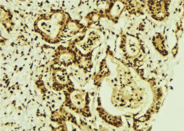 CEBPG / CEBP Gamma Antibody