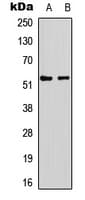 TP53 / p53 Antibody (N-Terminus)