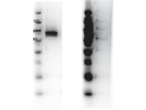 MST1R / RON Antibody