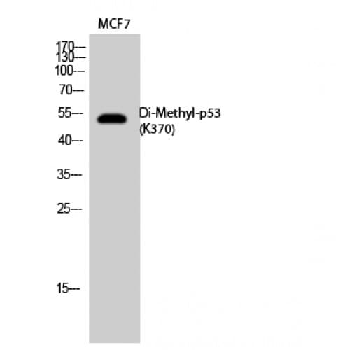 TP53 / p53 Antibody (di-methylation site of K370)