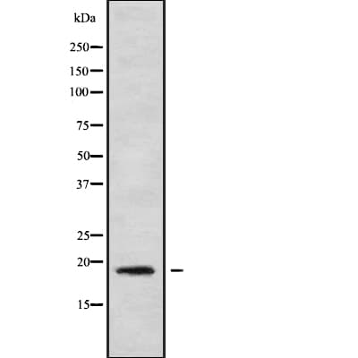 MRPL30 Antibody