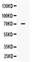 PLAP / Alkaline Phosphatase Antibody